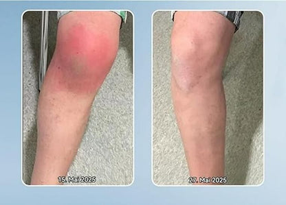 BPC-157 Gelenk-Helicreme 200 gm Pack of 2